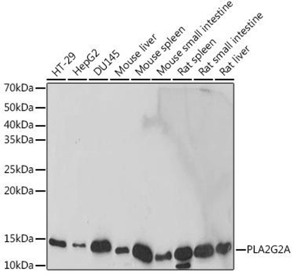 Anti-PLA2G2A Antibody CAB19252