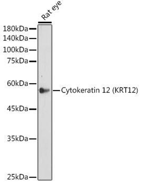 Anti-Cytokeratin 12 KRT12 Antibody CAB19284
