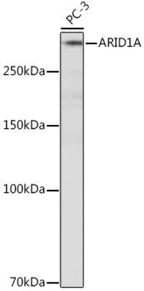 Anti-ARID1A Antibody CAB19570