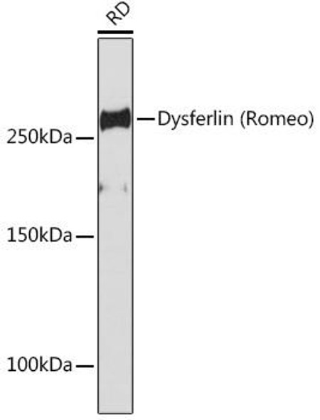 Anti-Dysferlin Romeo Antibody CAB19572