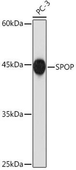 Anti-SPOP Antibody CAB19578