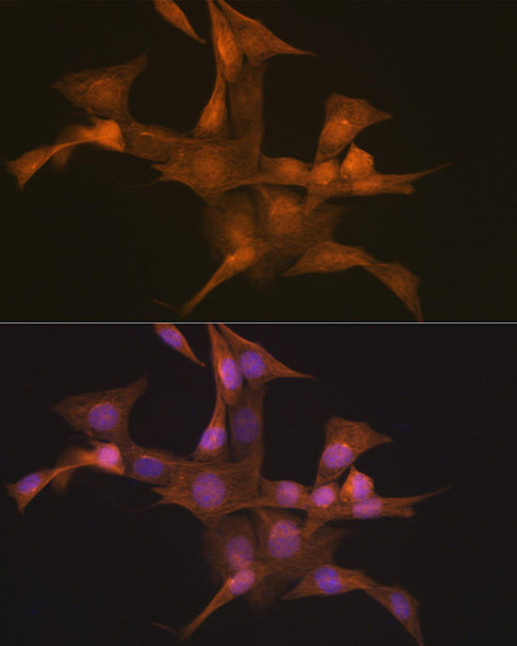 Anti-Nesprin 1 Antibody CAB19781