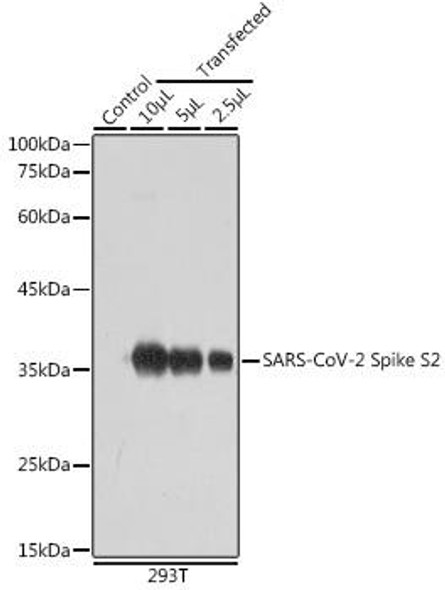 Anti-SARS-CoV-2 Spike S2 Antibody CAB20284