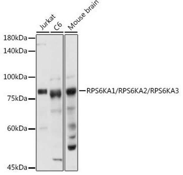 Anti-RPS6KA1/RPS6KA2/RPS6KA3 Antibody CAB20285