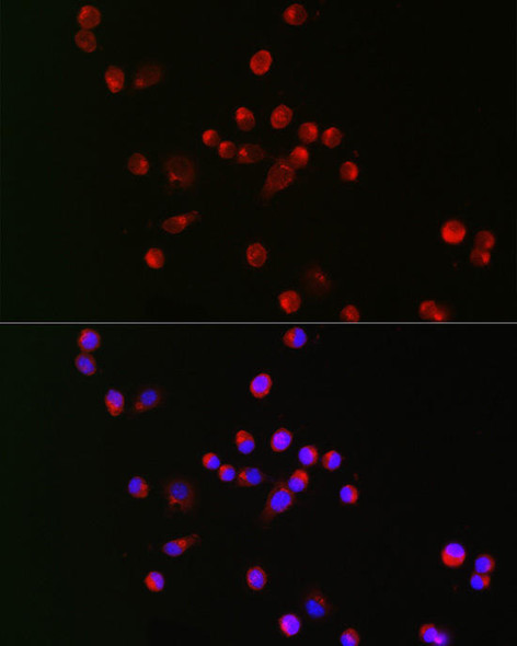 Anti-SCN10A Antibody CAB20459