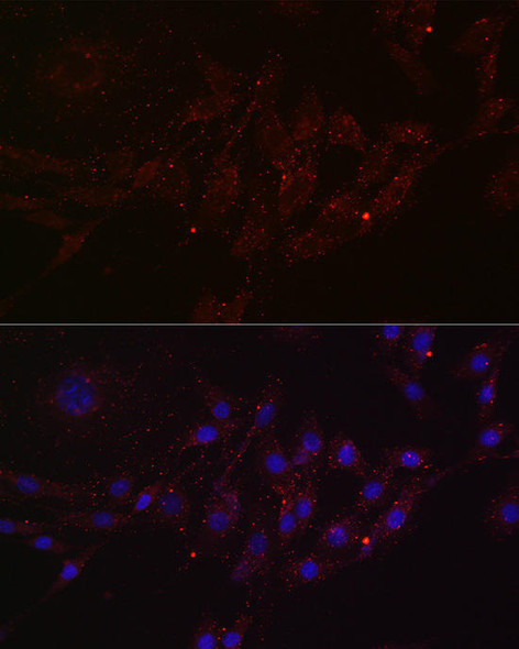 Anti-MGRN1 Antibody CAB20476