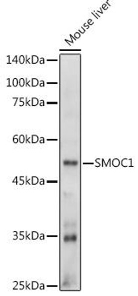 Anti-SMOC1 Antibody CAB20482