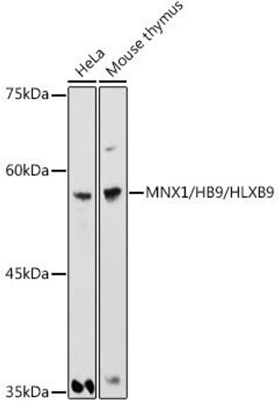 Anti-MNX1/HB9/HLXB9 Antibody CAB20537