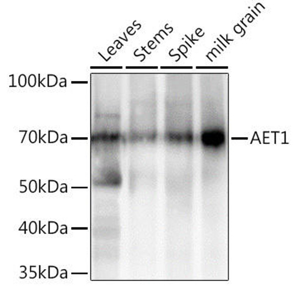 Anti-AET1 Antibody CAB20574