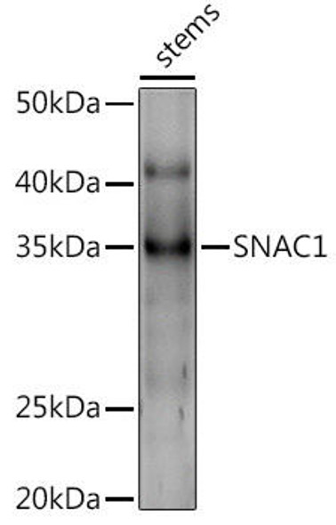 Anti-SNAC1 Antibody CAB20575
