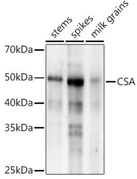 Anti-CSA Antibody CAB20577