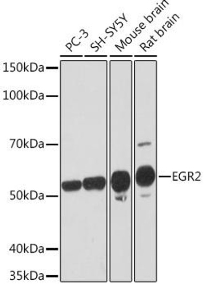 Anti-EGR2 Antibody CAB3219