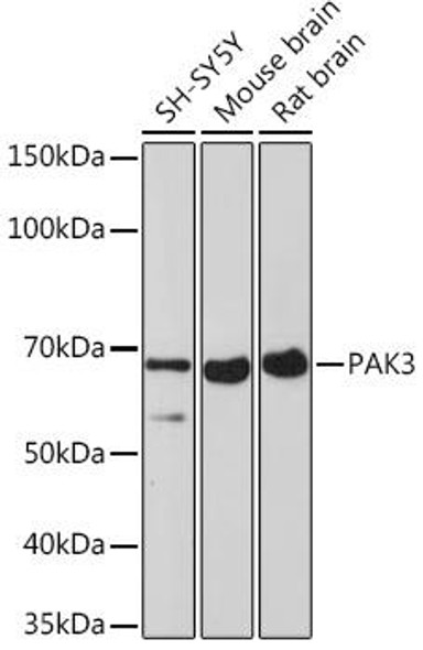 Anti-PAK3 Antibody CAB3363