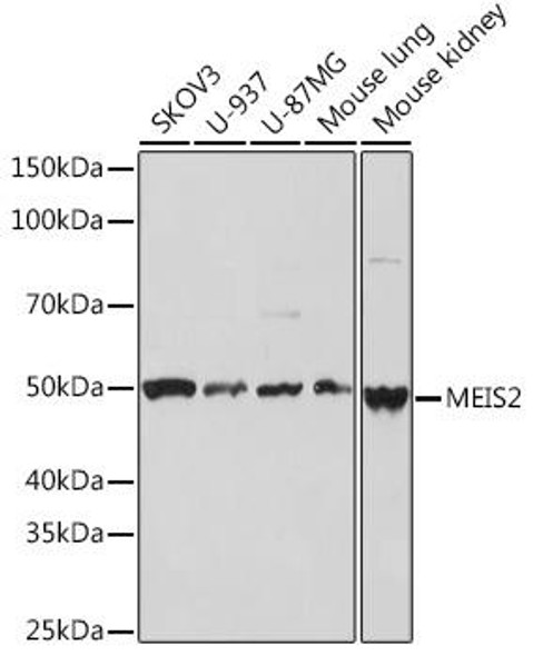 Anti-MEIS2 Antibody CAB3566