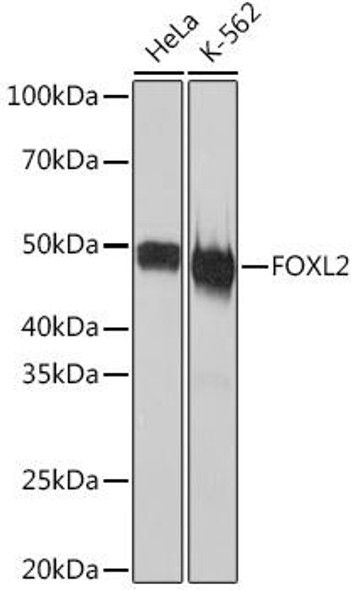 Anti-FOXL2 Antibody CAB3597