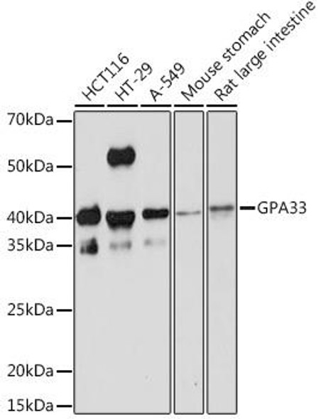 Anti-GPA33 Antibody CAB3608