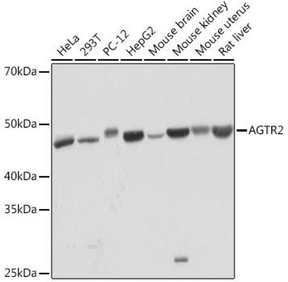 Anti-AGTR2 Antibody CAB3654