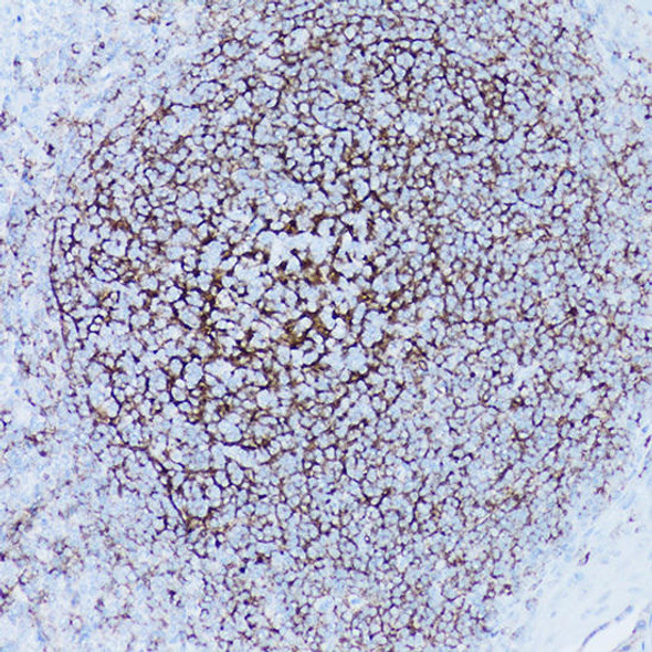 Anti-CD35/CR1 Antibody CAB3661