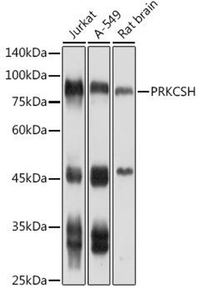 Anti-PRKCSH Antibody CAB4045