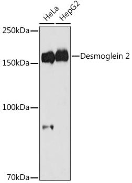 Anti-Desmoglein 2 Antibody CAB4489