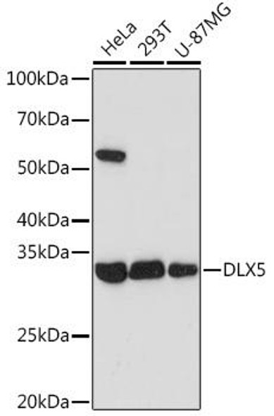 Anti-DLX5 Antibody CAB5586