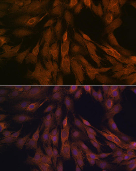 Anti-ULK3 Antibody CAB5959