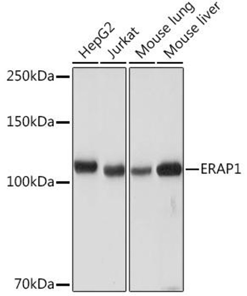 Anti-ERAP1 Antibody CAB5978