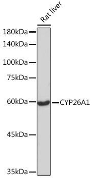 Anti-CYP26A1 Antibody CAB5982