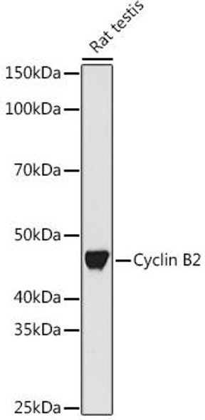 Anti-Cyclin B2 Antibody CAB7956