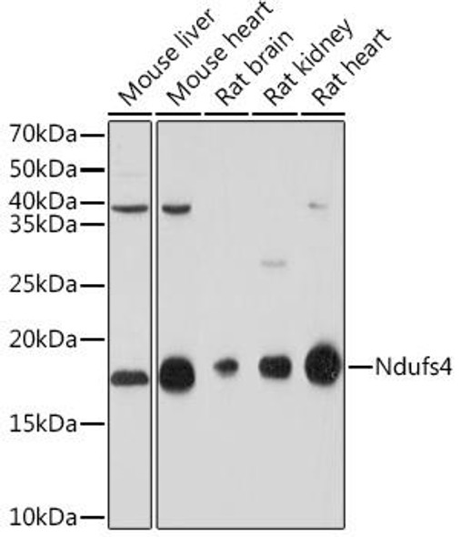 Anti-NDUFS4 Antibody CAB8691