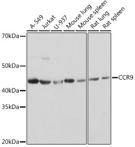 Anti-CCR9 Antibody CAB9698