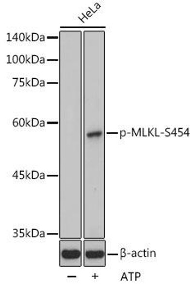 Anti-Phospho-MLKL-S454 Antibody CABP1173