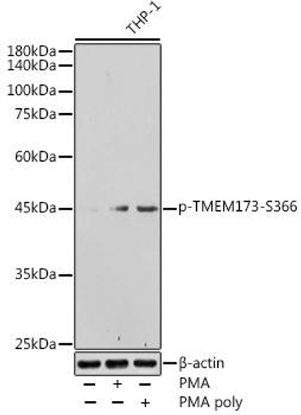 Anti-Phospho-TMEM173-S366 Antibody CABP1223