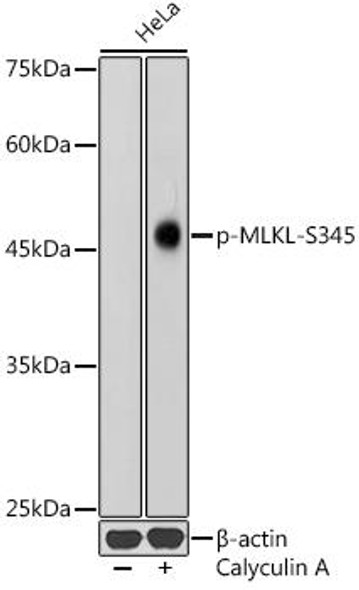 Anti-Phospho-MLKL-S345 Antibody CABP1255