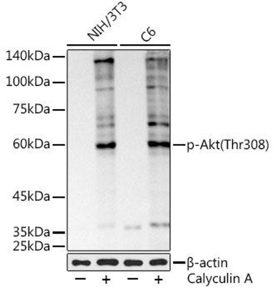 Anti-Phospho-Akt Thr308 Antibody CABP1259