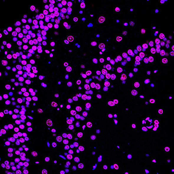 Paraffin embedded rat brain was treated with DNase I to fragment the DNA. DNA strand breaks showed intense fluorescent staining in DNase I treated sample (red). The cells were counterstained with DAPI (blue). This photo was taken by confocal microscope.