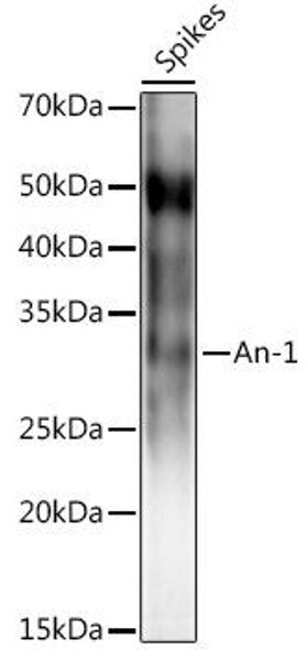 Western blot analysis of extracts of various tissues from the japonica rice (Oryza sativa L. ) variety Zhonghua 11, using An-1 antibody at 1:1000 dilution. Secondary antibody: HRP Goat Anti-Rabbit IgG (H+L) at 1:10000 dilution. Lysates/proteins: 25ug per lane. Blocking buffer: 3% nonfat dry milk in TBST. Detection: ECL Enhanced Kit. Exposure time: 3s.