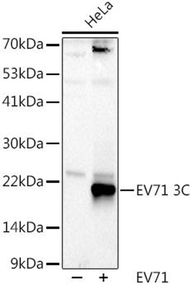 Western blot analysis of extracts of HeLa cells, using EV71 3C antibody at 1:1000 dilution. Secondary antibody: HRP Goat Anti-Rabbit IgG (H+L) at 1:10000 dilution. Lysates/proteins: 25ug per lane. Blocking buffer: 3% nonfat dry milk in TBST. Detection: ECL Basic Kit. Exposure time: 90s.