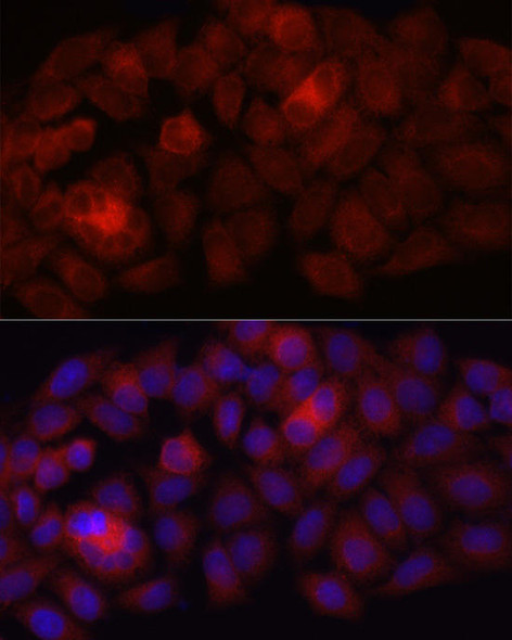 Immunofluorescence analysis of HeLa cells using Folate Binding Protein(FBP) / FOLR1 Rabbit mAb at dilution of 1:100 (40x lens). Blue: DAPI for nuclear staining.