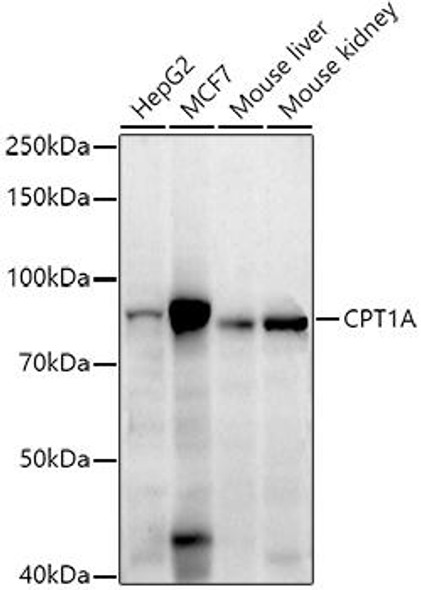 Western blot analysis of extracts of various cell lines, using CPT1A antibody at 1:1000 dilution. Secondary antibody: HRP Goat Anti-Rabbit IgG (H+L) at 1:10000 dilution. Lysates/proteins: 25ug per lane. Blocking buffer: 3% nonfat dry milk in TBST. Detection: ECL Enhanced Kit. Exposure time: 180s.