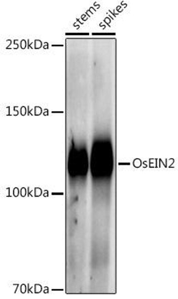 Western blot analysis of extracts of various tissues from the japonica rice (Oryza sativa L. ) variety Zhonghua 11, using OsEIN2 antibody at 1:1000 dilution. Secondary antibody: HRP Goat Anti-Rabbit IgG (H+L) at 1:10000 dilution. Lysates/proteins: 25ug per lane. Blocking buffer: 3% nonfat dry milk in TBST. Detection: ECL Enhanced Kit. Exposure time: 30s.