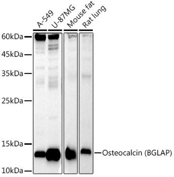 Western blot analysis of extracts of various cell lines, using Osteocalcin (BGLAP) antibody at 1:1000 dilution. Secondary antibody: HRP Goat Anti-Rabbit IgG (H+L) at 1:10000 dilution. Lysates/proteins: 25ug per lane. Blocking buffer: 3% nonfat dry milk in TBST. Detection: ECL Basic Kit. Exposure time: 30s.
