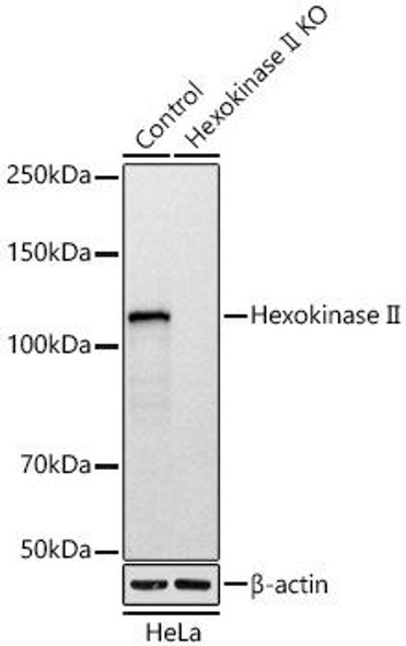 Western blot analysis of extracts from normal (control) and Hexokinase II knockout (KO) HeLa cells, using Hexokinase II antibody at 1:1000 dilution. Secondary antibody: HRP Goat Anti-Rabbit IgG (H+L) at 1:10000 dilution. Lysates/proteins: 25ug per lane. Blocking buffer: 3% nonfat dry milk in TBST. Detection: ECL Basic Kit. Exposure time: 10s.
