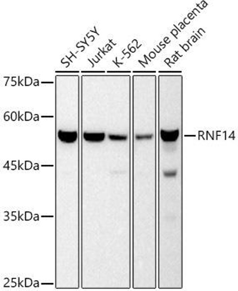 Western blot analysis of extracts of various cell lines, using RNF14 antibody at 1:500 dilution. Secondary antibody: HRP Goat Anti-Rabbit IgG (H+L) at 1:10000 dilution. Lysates/proteins: 25ug per lane. Blocking buffer: 3% nonfat dry milk in TBST. Detection: ECL Basic Kit. Exposure time: 10s.