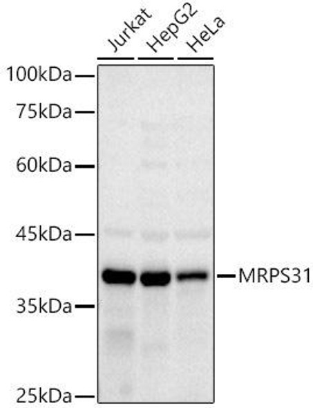 Western blot analysis of extracts of various cell lines, using MRPS31 antibody at 1:1000 dilution. Secondary antibody: HRP Goat Anti-Rabbit IgG (H+L) at 1:10000 dilution. Lysates/proteins: 25ug per lane. Blocking buffer: 3% nonfat dry milk in TBST. Detection: ECL Basic Kit. Exposure time: 180s.