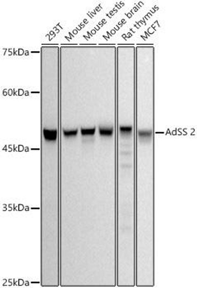 Western blot analysis of extracts of various cell lines, using AdSS 2 antibody at 1:500 dilution. Secondary antibody: HRP Goat Anti-Rabbit IgG (H+L) at 1:10000 dilution. Lysates/proteins: 25ug per lane. Blocking buffer: 3% nonfat dry milk in TBST. Detection: ECL Basic Kit. Exposure time: 10s.