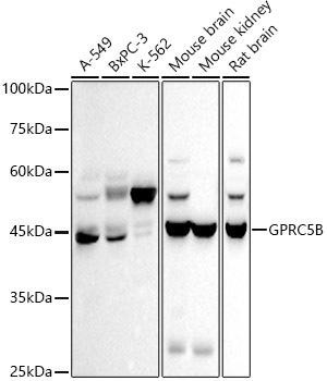 Western blot analysis of extracts of various cell lines, using GPRC5B antibody at 1:500 dilution. Secondary antibody: HRP Goat Anti-Rabbit IgG (H+L) at 1:10000 dilution. Lysates/proteins: 25ug per lane. Blocking buffer: 3% nonfat dry milk in TBST. Detection: ECL Basic Kit. Exposure time: 30s.
