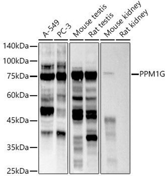 Western blot analysis of extracts of various cell lines, using PPM1G antibody at 1:500 dilution. Secondary antibody: HRP Goat Anti-Rabbit IgG (H+L) at 1:10000 dilution. Lysates/proteins: 25ug per lane. Blocking buffer: 3% nonfat dry milk in TBST. Detection: ECL Basic Kit. Exposure time: 60s.