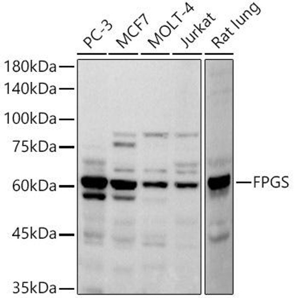 Western blot analysis of extracts of various cell lines, using FPGS antibody at 1:500 dilution. Secondary antibody: HRP Goat Anti-Rabbit IgG (H+L) at 1:10000 dilution. Lysates/proteins: 25ug per lane. Blocking buffer: 3% nonfat dry milk in TBST. Detection: ECL Basic Kit. Exposure time: 90s.