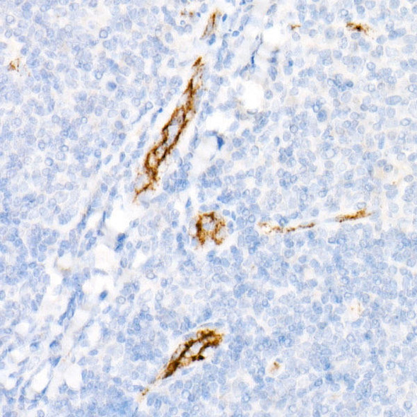 Immunohistochemistry of paraffin-embedded human tonsil using von Willebrand factor (VWF) antibody at dilution of 1:800 (40x lens). Perform high pressure antigen retrieval with 10 mM citrate buffer pH 6. 0 before commencing with IHC staining protocol.